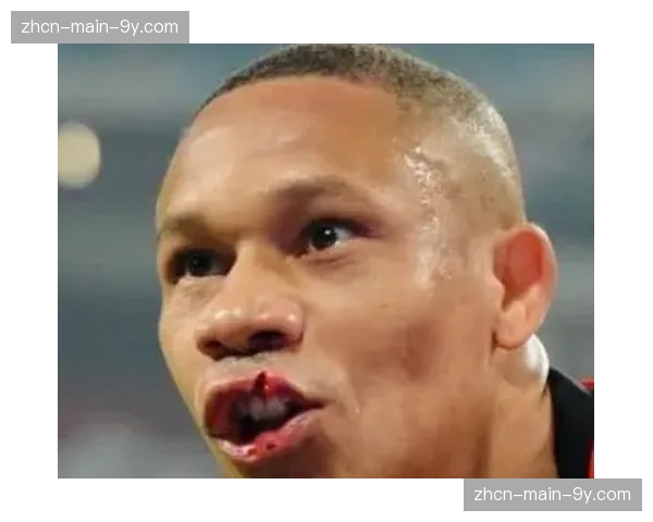 韦林顿带伤作战：嘴唇缝15针后2分钟破门，展现顽强斗志